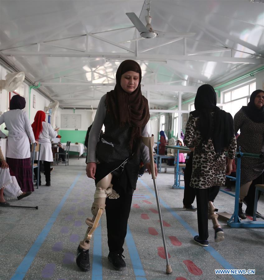 AFGHANISTAN-KABUL-ORTHOPEDIC CENTER-CIVILIAN CASUALTIES